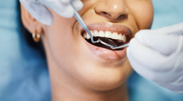 Best Pediatric Emergency Dentist in Willowbrook, CA